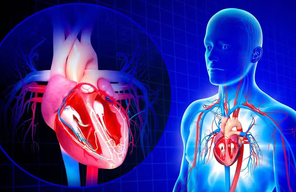 Infarto x Parada Cardíaca